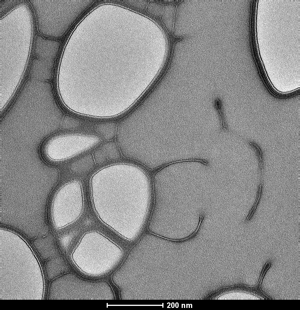 Dark Fresnel fringes.